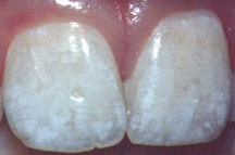 ���������� ����� ������������� �������