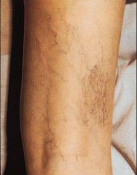 � ������������ ����������� ���������� ��� 